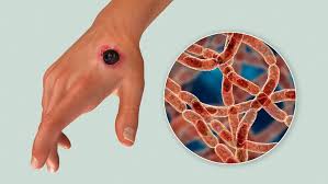 Nigerian Government Confirms Anthrax Outbreak in Zamfara, Urges Public Caution