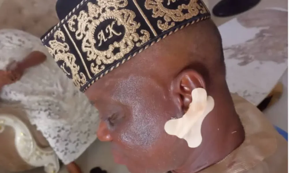 Village chief attacks monarch in Ondo, bites his ears