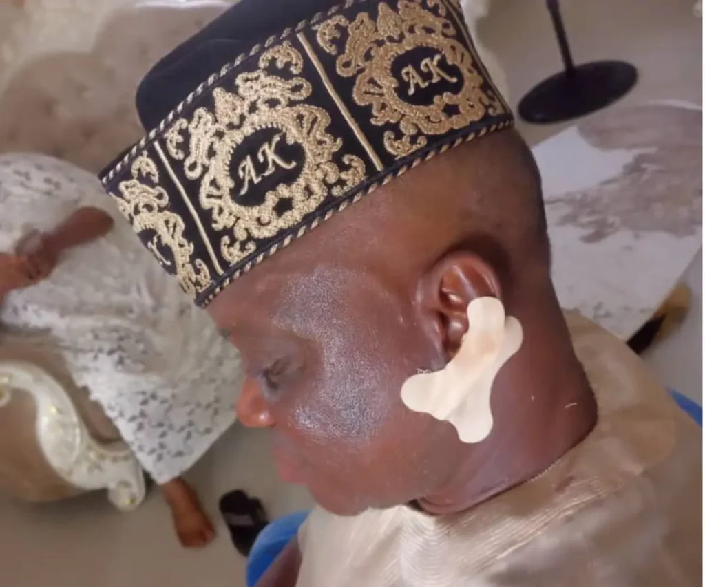 Village chief attacks monarch in Ondo, bites his ears